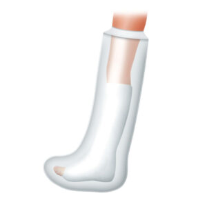Kifidis Silikon Girişli Alçı Ve Bandaj Koruyucu (bacak Uzun)